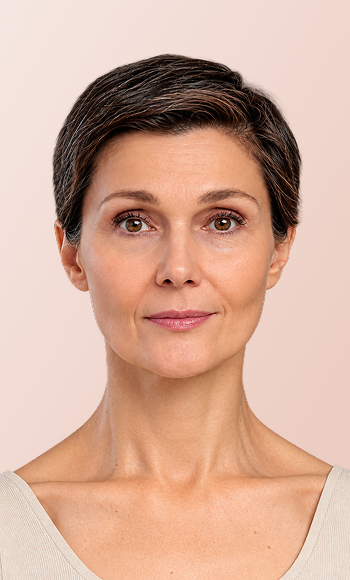 Before and after results of a lip filler treatment at Desert Med Rejuvenation. Individual results may vary.